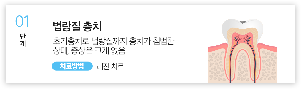 01.법랑질 충치