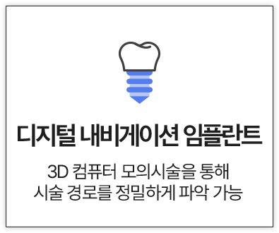 디지털 내비게이션 임플란트