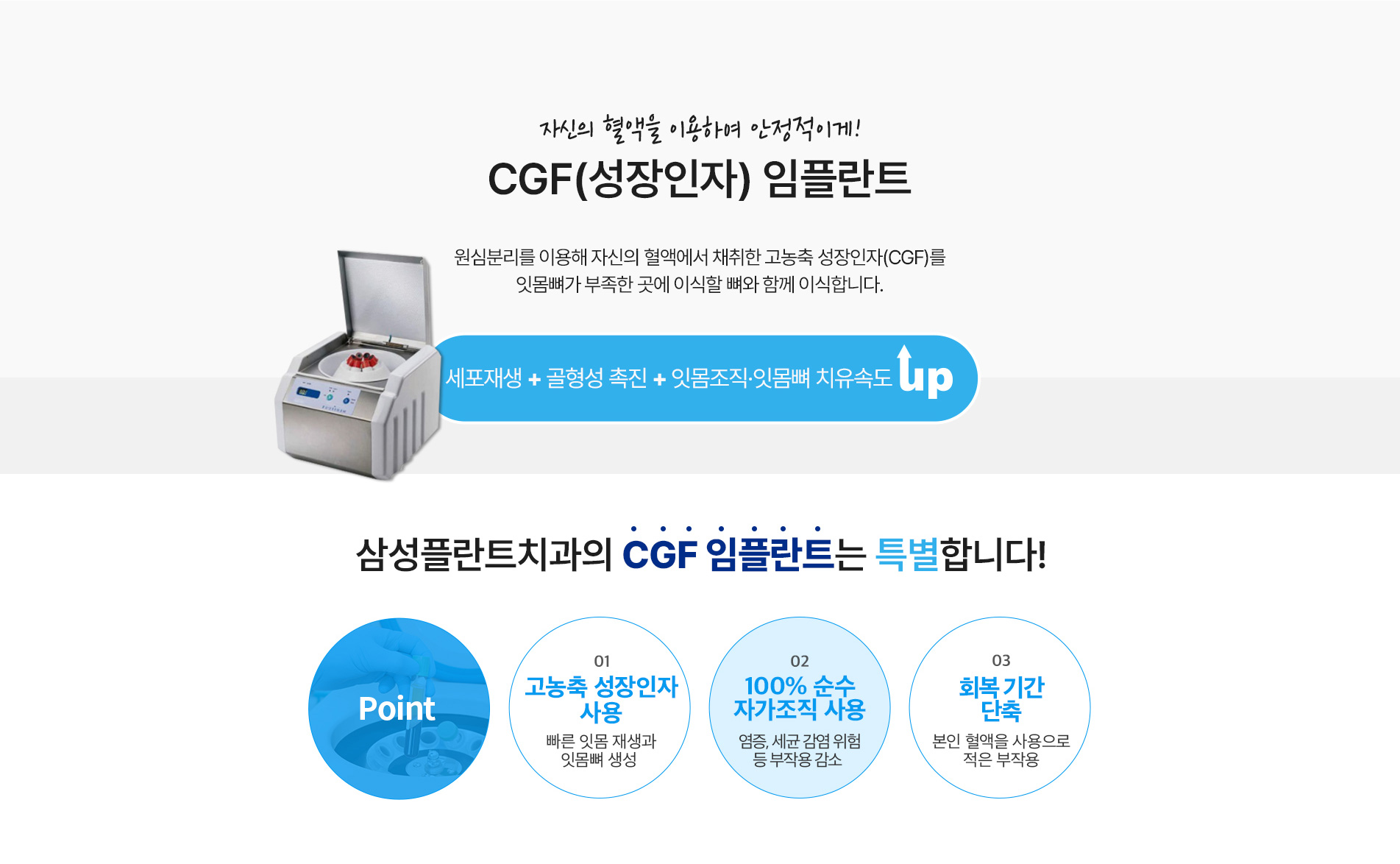 CGF(성장인자) 임플란트